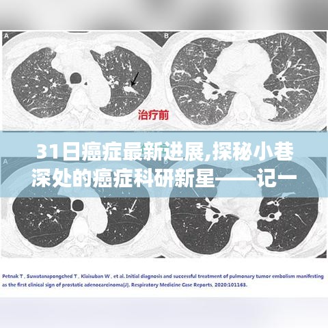 都市纹理中的癌症突破奇迹，最新科研进展与小巷深处的科研新星探秘