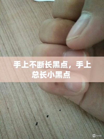 手上不断长黑点，手上总长小黑点 