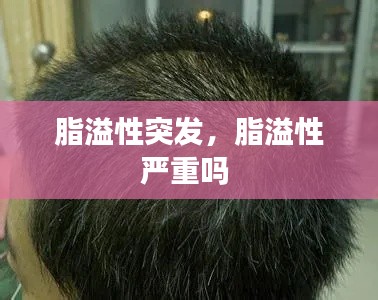 脂溢性突发，脂溢性严重吗 