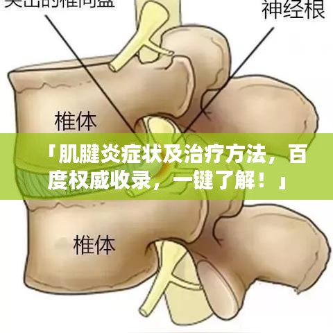 「肌腱炎症状及治疗方法，百度权威收录，一键了解！」