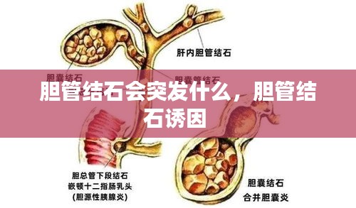 胆管结石会突发什么，胆管结石诱因 